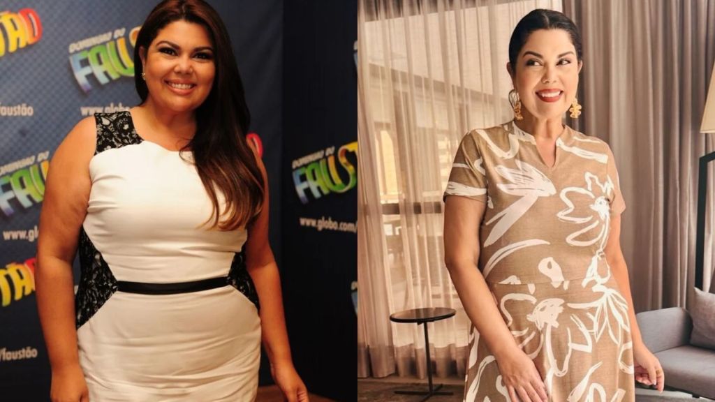 Antes de depois de Fabiana Carla após processo de emagrecimento
