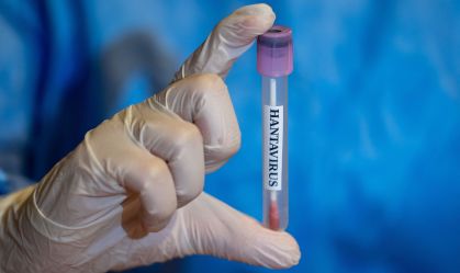 Hantavirus
