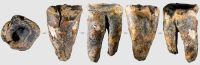 Dente em caverna da Sibéria revela cirurgia dentária pré-histórica
