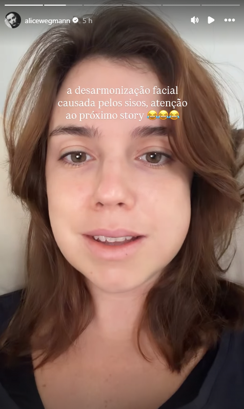 Alice Wegmann mostra rosto inchado após retirada de sisos • Instagram/Alice Wegmann