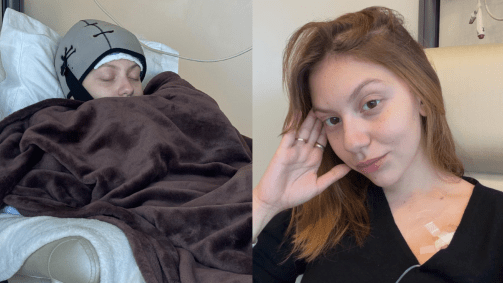 Bruna Furlan Nóbrega descobriu um câncer de mama aos 24 anos
