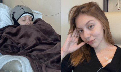 Bruna Furlan Nóbrega descobriu um câncer de mama aos 24 anos