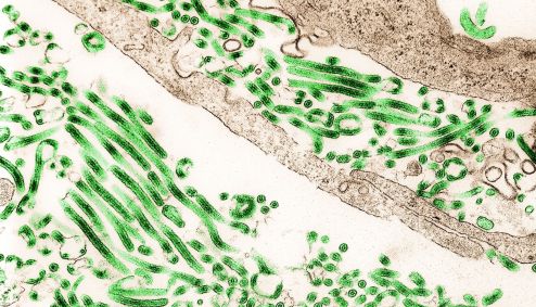 Vírus do Ebola visto no microscópio