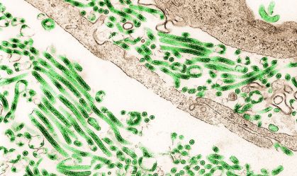 Vírus do Ebola visto no microscópio
