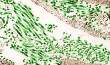 Vírus do Ebola visto no microscópio
