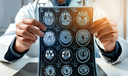 MRI Brain Scan. Doctor shows MRI Brain Scan of head and skull.