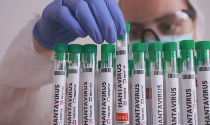 hantavirus-amostrar-2_b3a45f