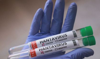 hantavirus-amostrar-4