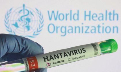 hantavirus-amostras-3