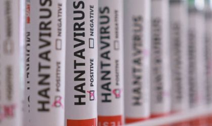 hantavirus-amostras