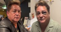 Leonardo explica acidente em pescaria que causou fratura no rosto