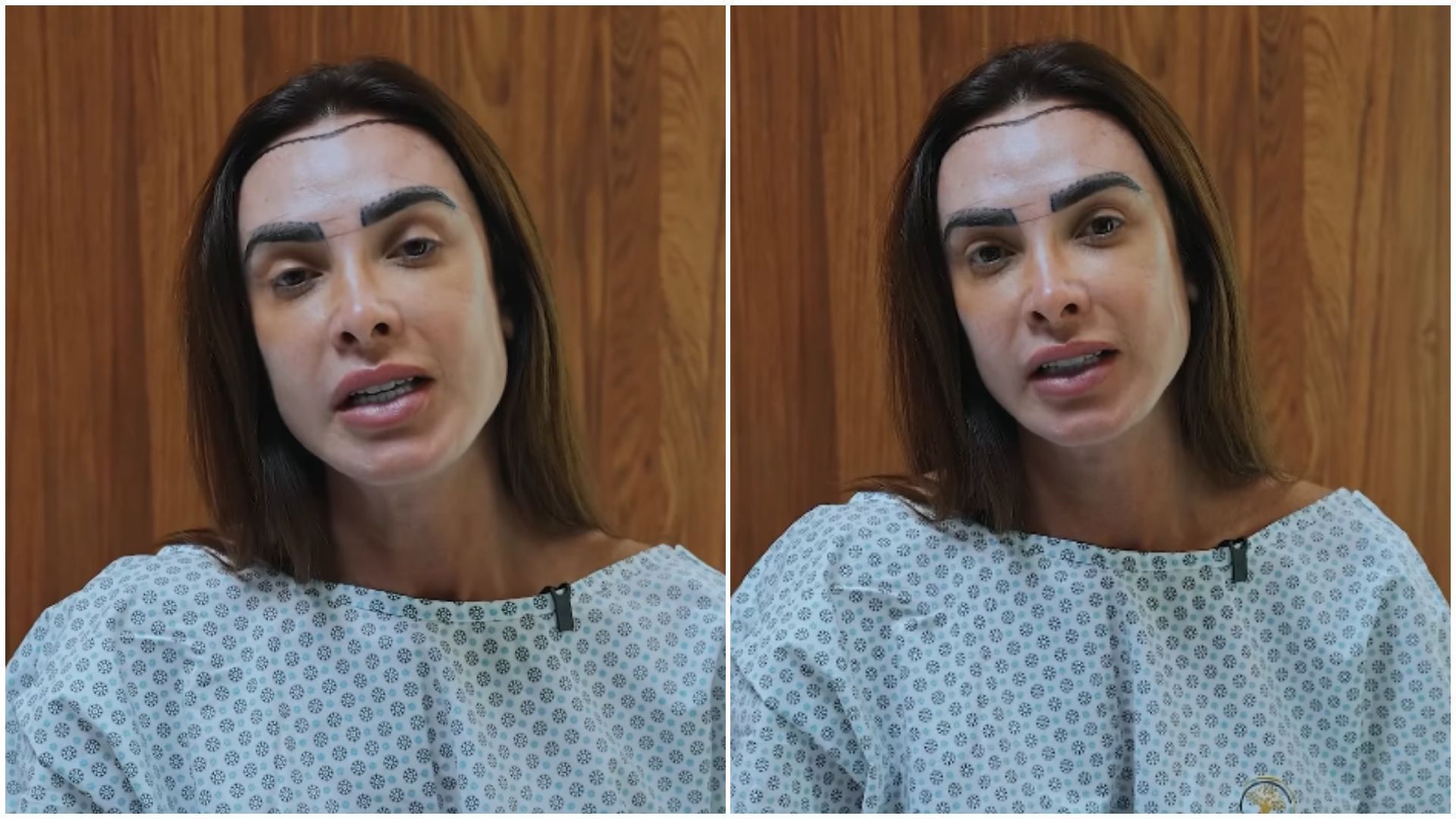 nicole-bahls-transplante-capilar