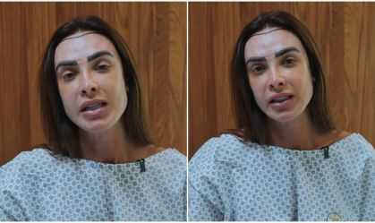 nicole-bahls-transplante-capilar