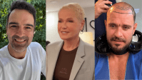 Como Xuxa Meneghel, veja famosos que fizeram transplante capilar
