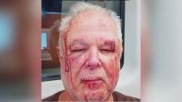 Violência contra idosos cresce 38% no Brasil; especialistas fazem alerta