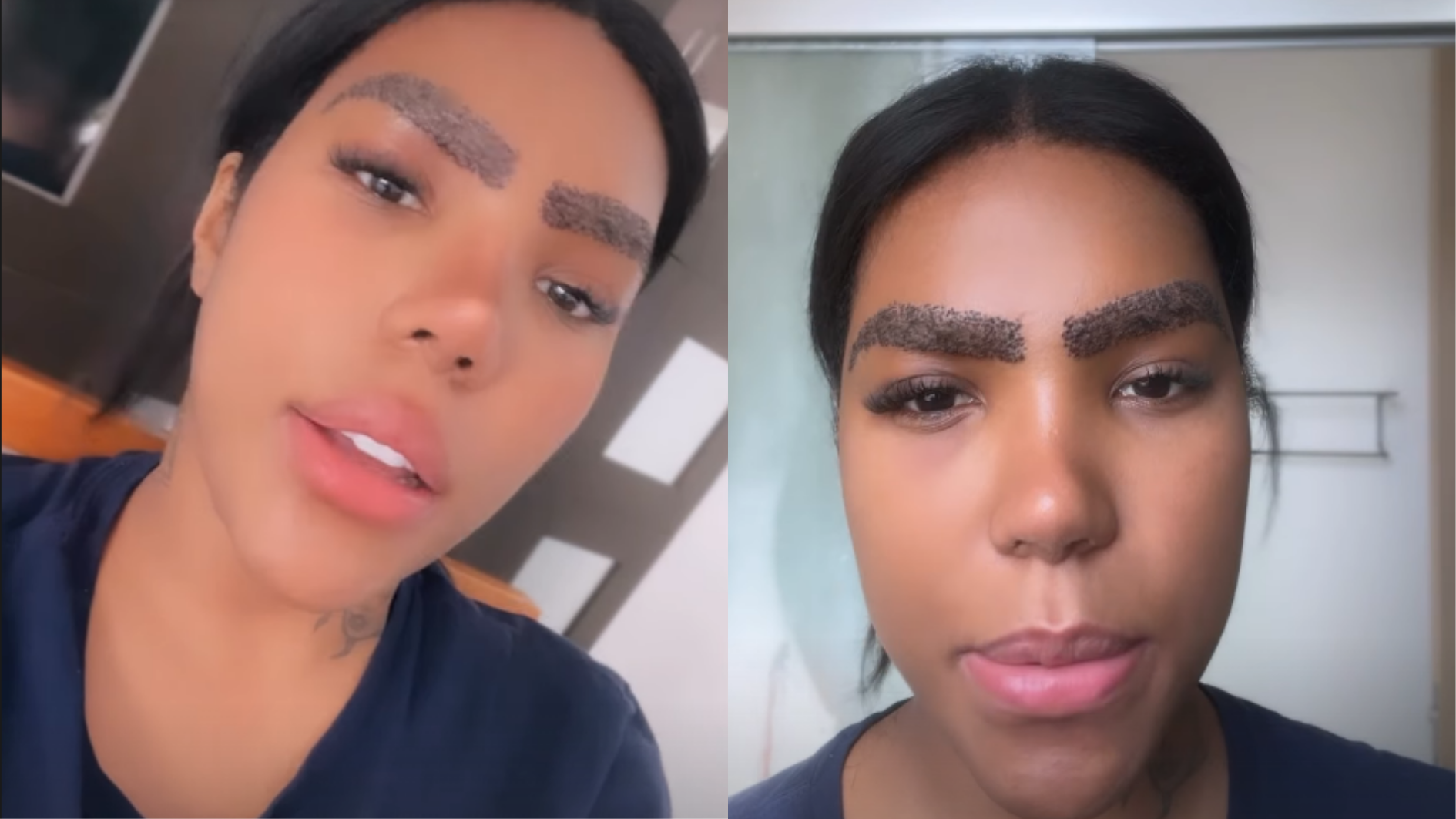Carol Lekker após transplante de sobrancelha • Reprodução/Instagram