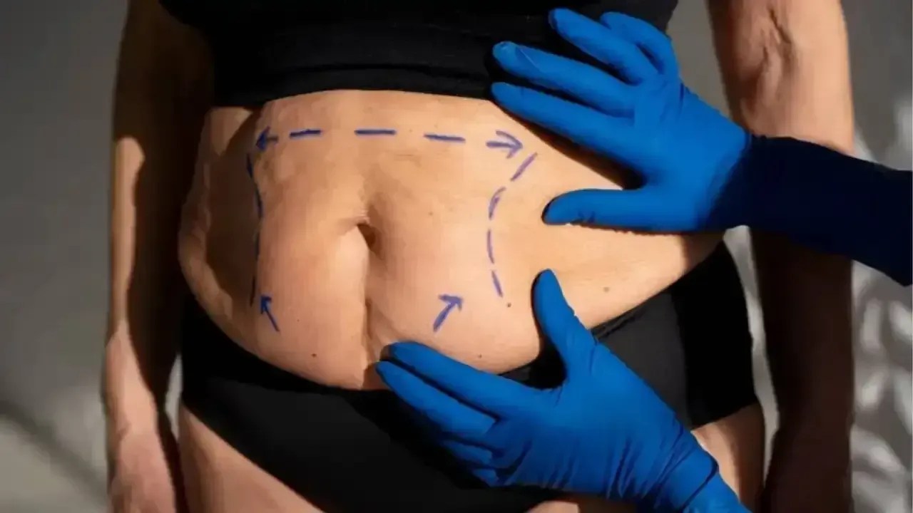 cirurgia-plastica