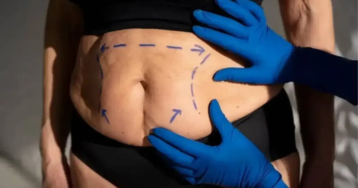 Cirurgia plástica melhora a autoestima mesmo ou é só uma ilusão?