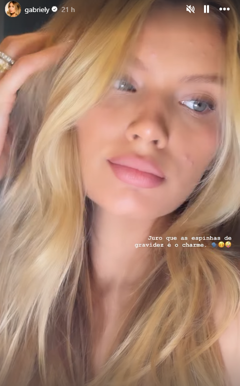 Gabriely Miranda expôs espinhas no rosto aos seguidores • Instagram/@gabriely