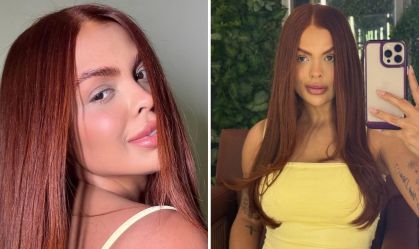 Imagem de destaque do post: Ex-BBB Paula revela "grumos" no pescoço durante lipo: "Raspou tudo"