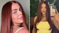 Ex-BBB Paula revela "grumos" no pescoço durante lipo: "Raspou tudo"