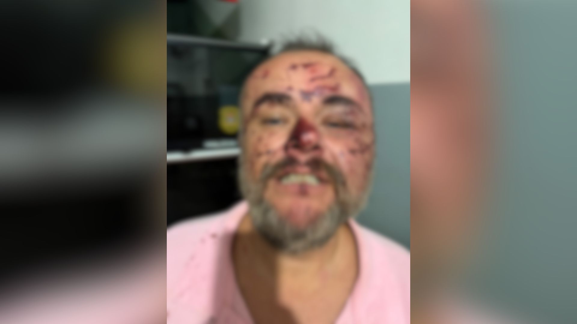 Advogado com hematomas graves no rosto dentro de viatura da Polícia Militar