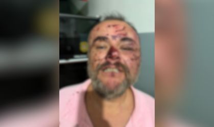 Advogado com hematomas graves no rosto dentro de viatura da Polícia Militar