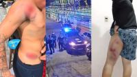 Moradores de Guarulhos denunciam perseguição da Guarda Municipal