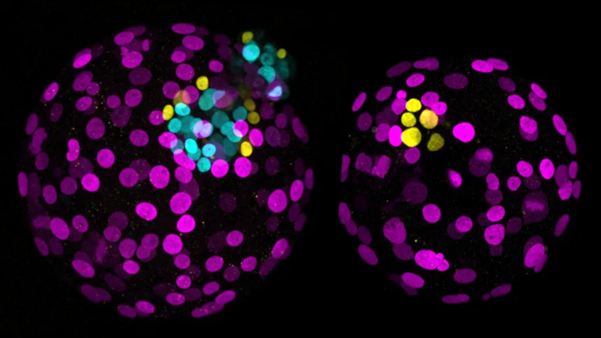 Com a simples remoção de um gene, cientistas esperam eliminar o colesterol alto para sempre