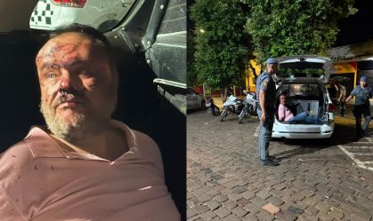 Advogado com hematomas graves no rosto dentro de viatura da Polícia Militar