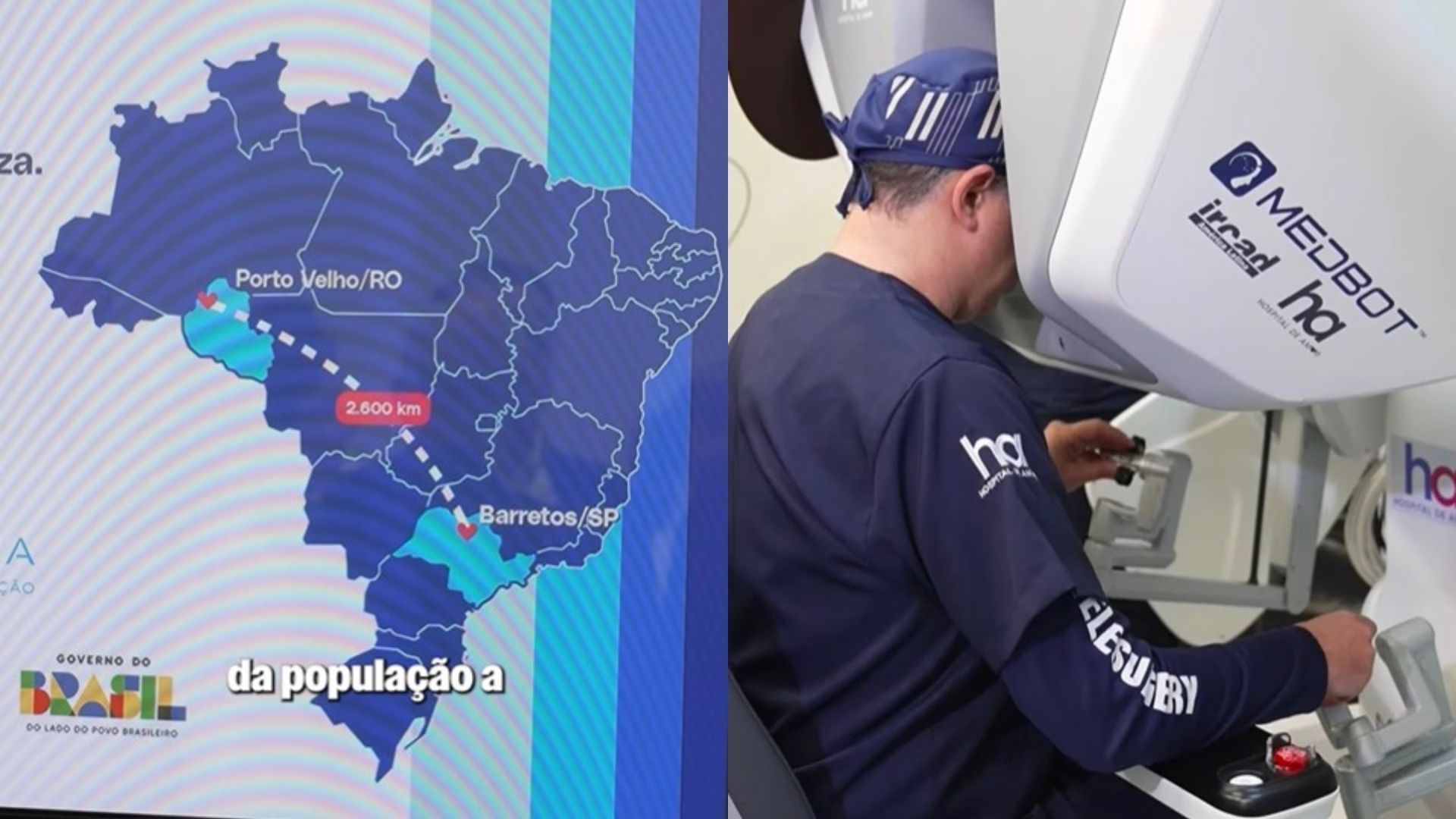 Paciente do SUS na Amazônia passa por 1ª telecirurgia robótica oncológica