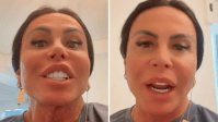 Gretchen rebate críticas sobre procedimento: "Meu marido gosta"
