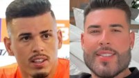 De Vini Jr. a Ivan: relembre jogadores que fizeram harmonização facial