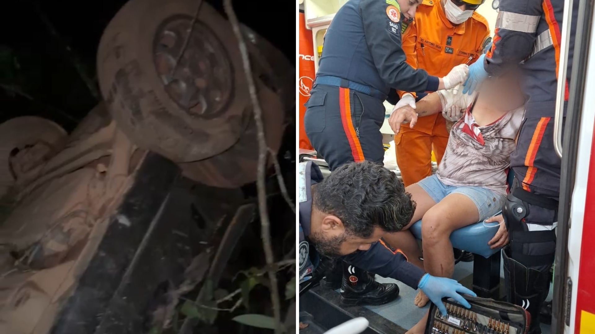 mulher tinha lesões graves no braço direito, com fraturas aberta e fechada