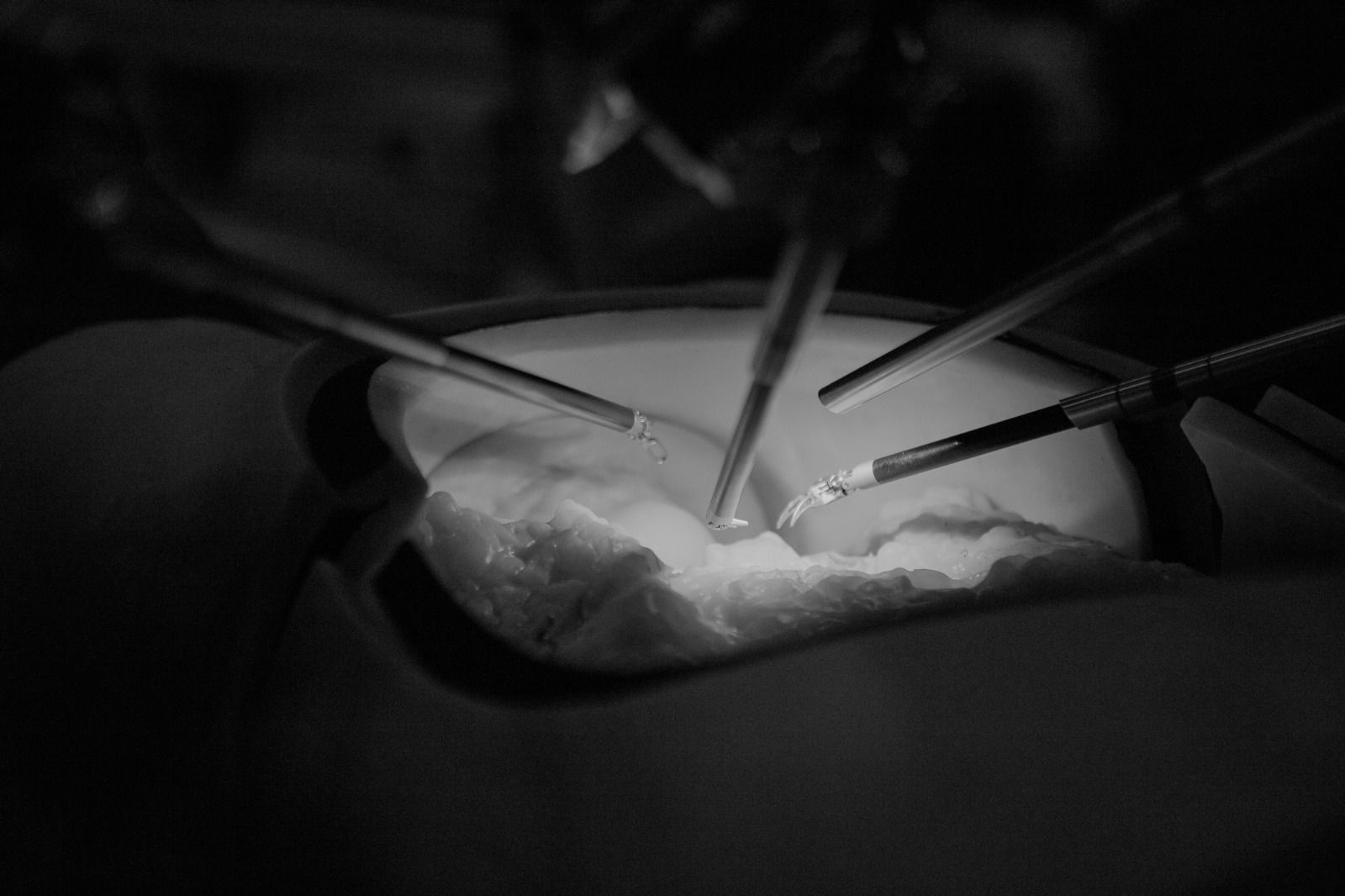 cirurgia-feita-a-distância