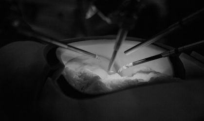 cirurgia-feita-a-distância