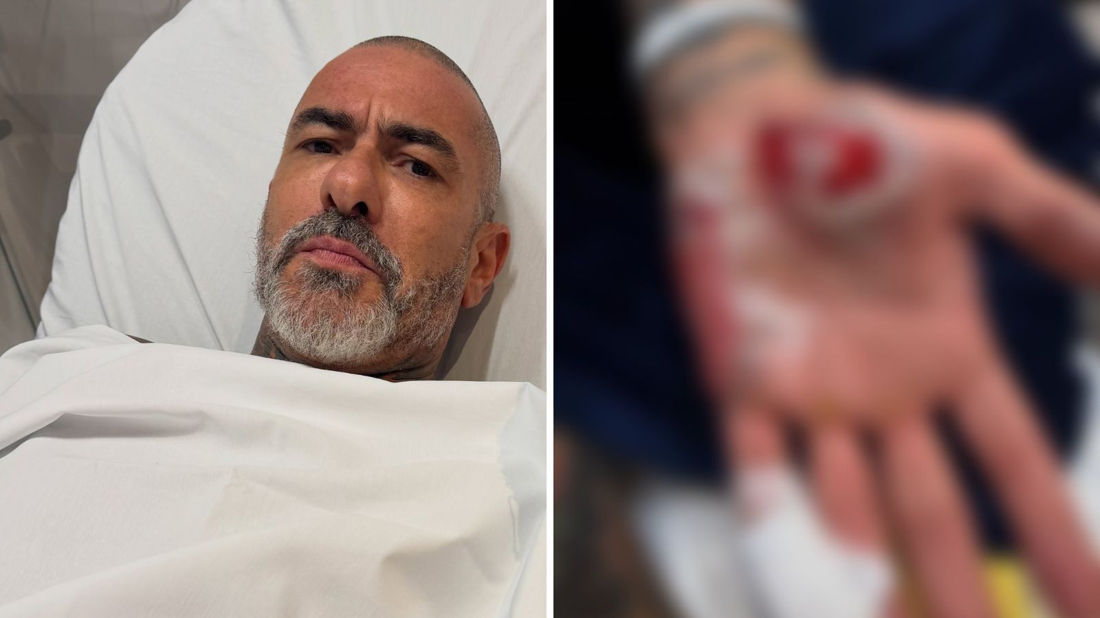 Fogaça detalha acidente de moto após gravações de do MasterChef