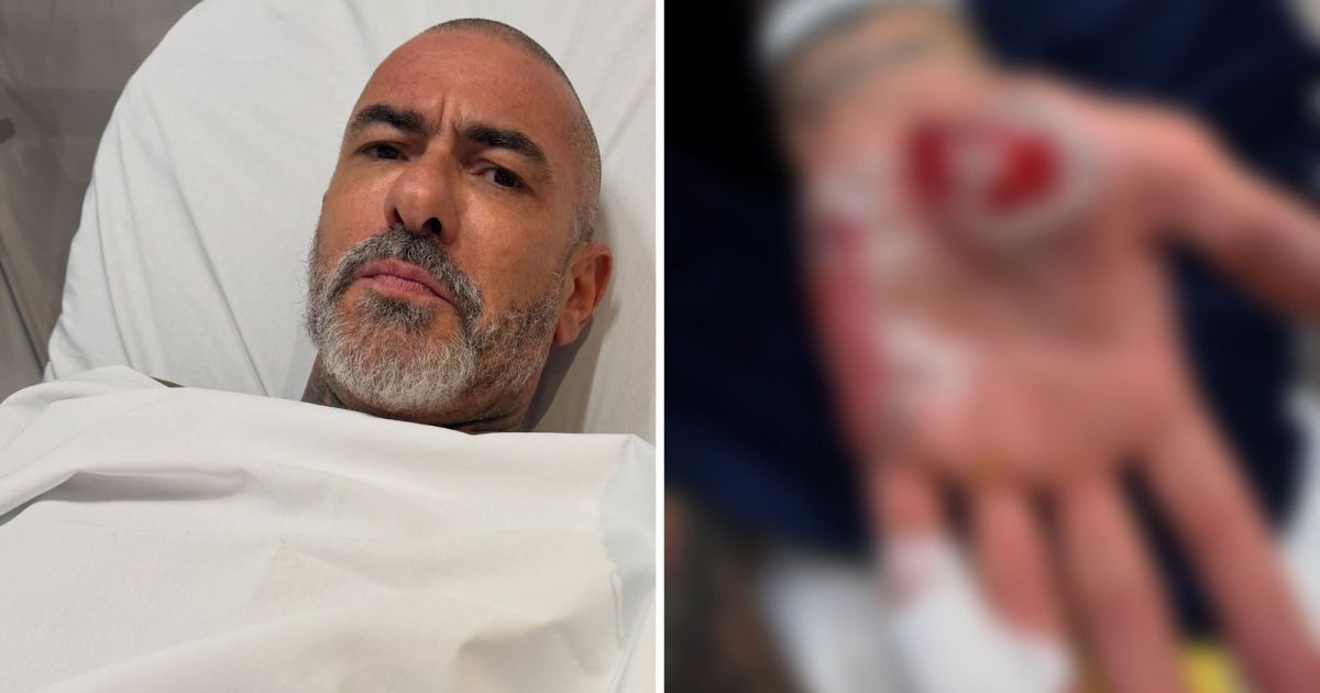 Fogaça sofre acidente de moto e denuncia roubo de aliança em hospital