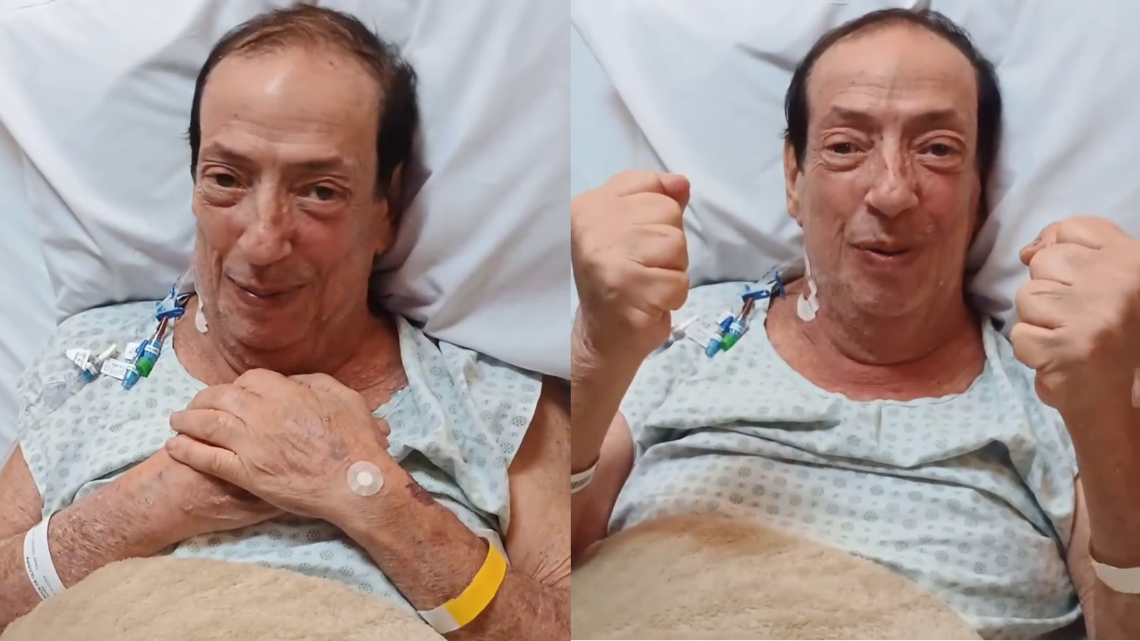 Ator conhecido pelo papel de Beiçola está internado após passar por cirurgia