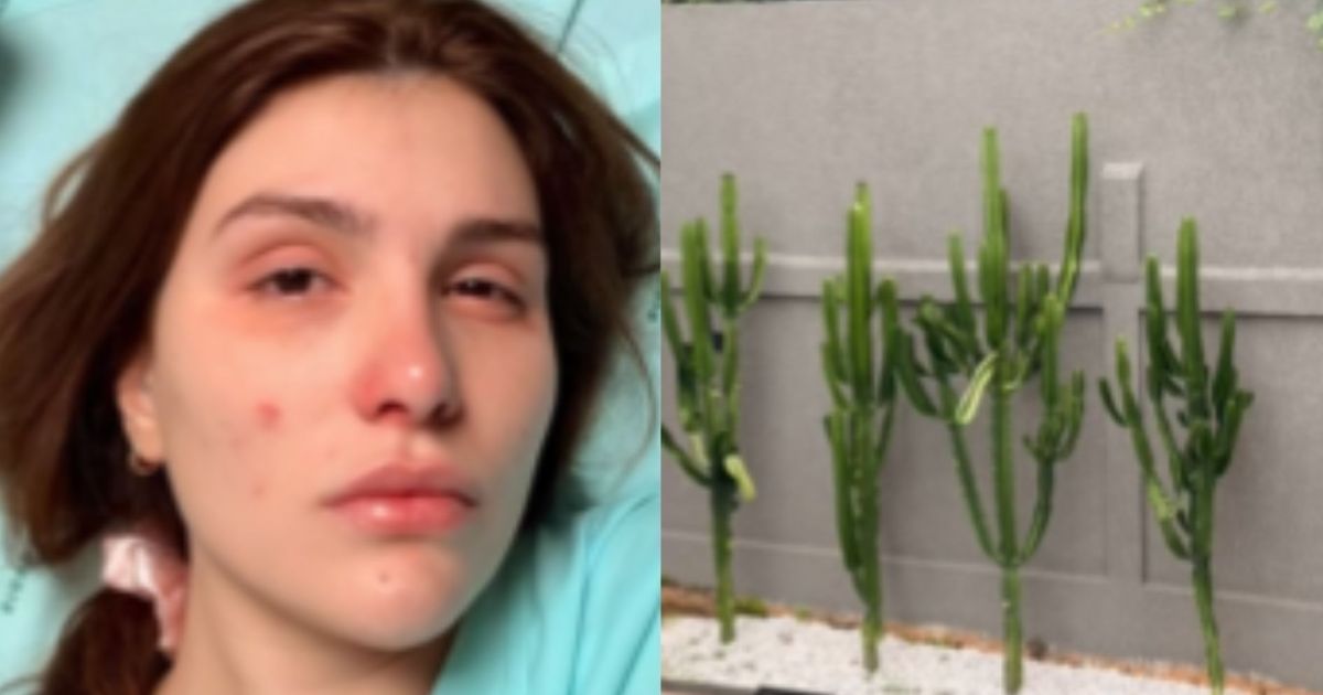 Influenciadora sofre lesão nos olhos após podar cacto: “Quase fiquei cega”
