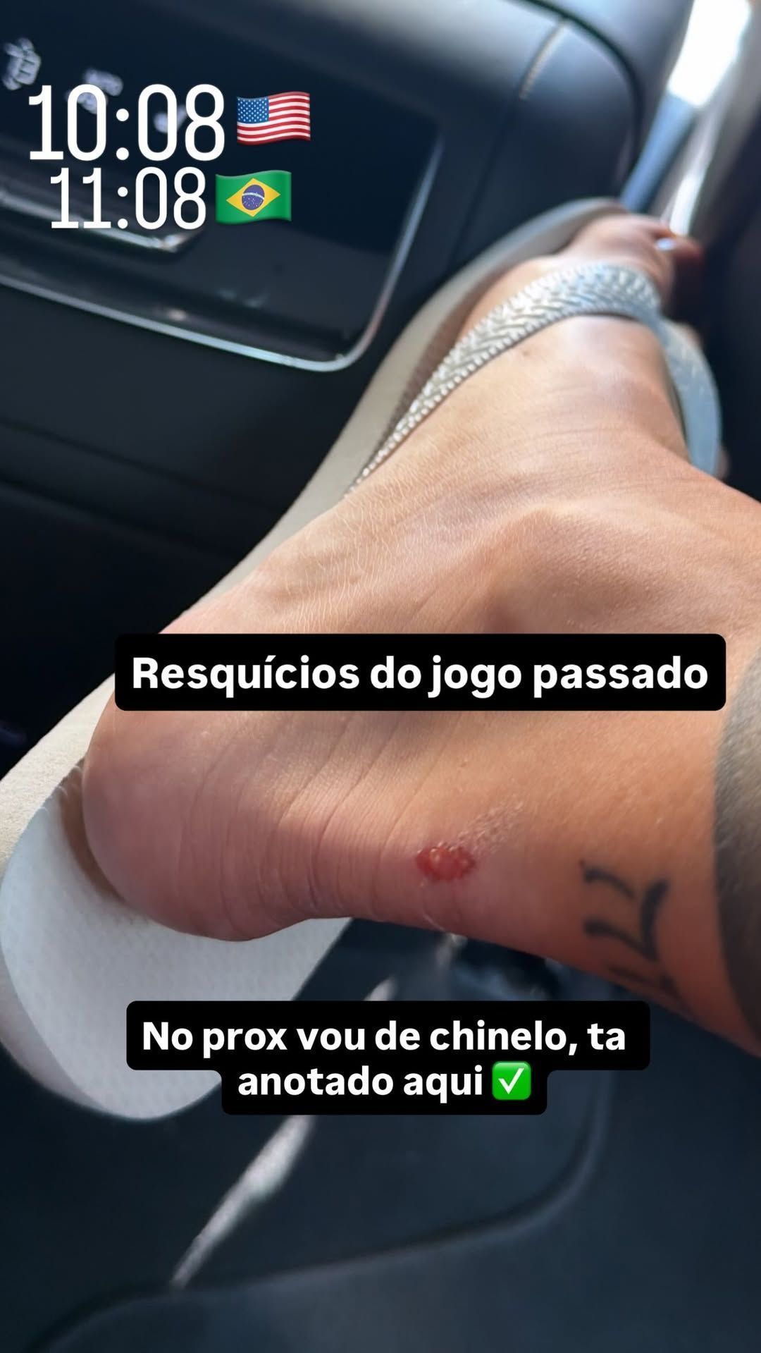 Virginia Fonseca mostra pé machucado após jogo do Brasil contra o Japão, pela Copa do Mundo de 2026 • Instagram/Virginia