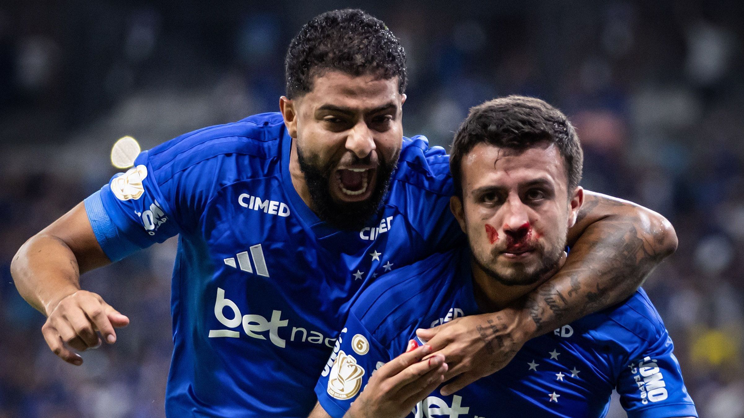 Imagem de destaque do post: Matheus Henrique fica com o rosto ensanguentado após gol do Cruzeiro; veja