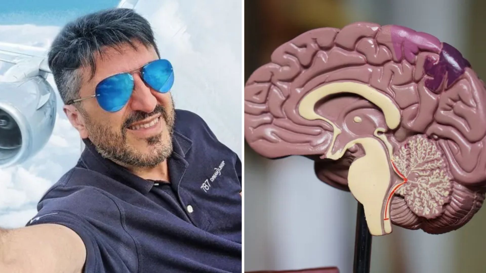 Lito Sousa e Creutzfeld-Jacob entenda doença degenerativa dos movimentos