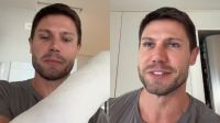 Ex-BBB Jonas Sulzbach relata dificuldades após fraturar o braço