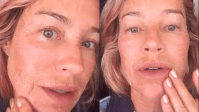 Luana Piovani explica descamação no rosto: "Fazendo 50 com cara de 100"