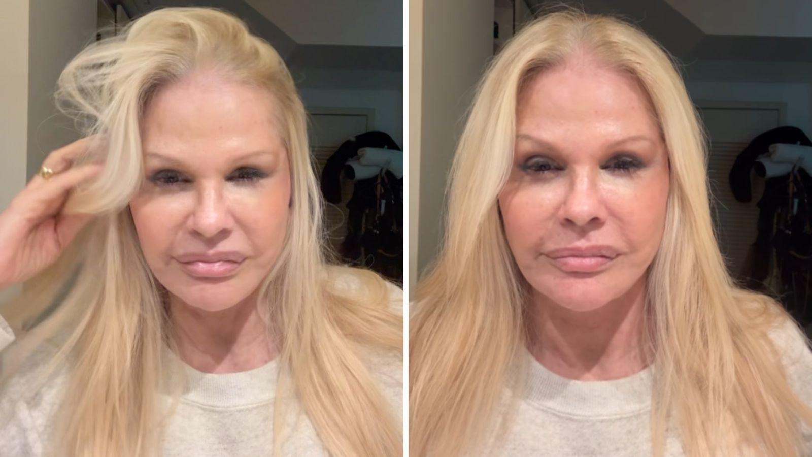 Monique Evans fica chocada com resultado de procedimento facial