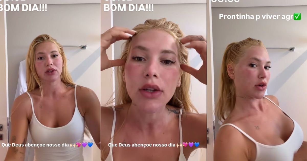“Reações são esperadas”, dizem especialistas após procedimento de Virginia