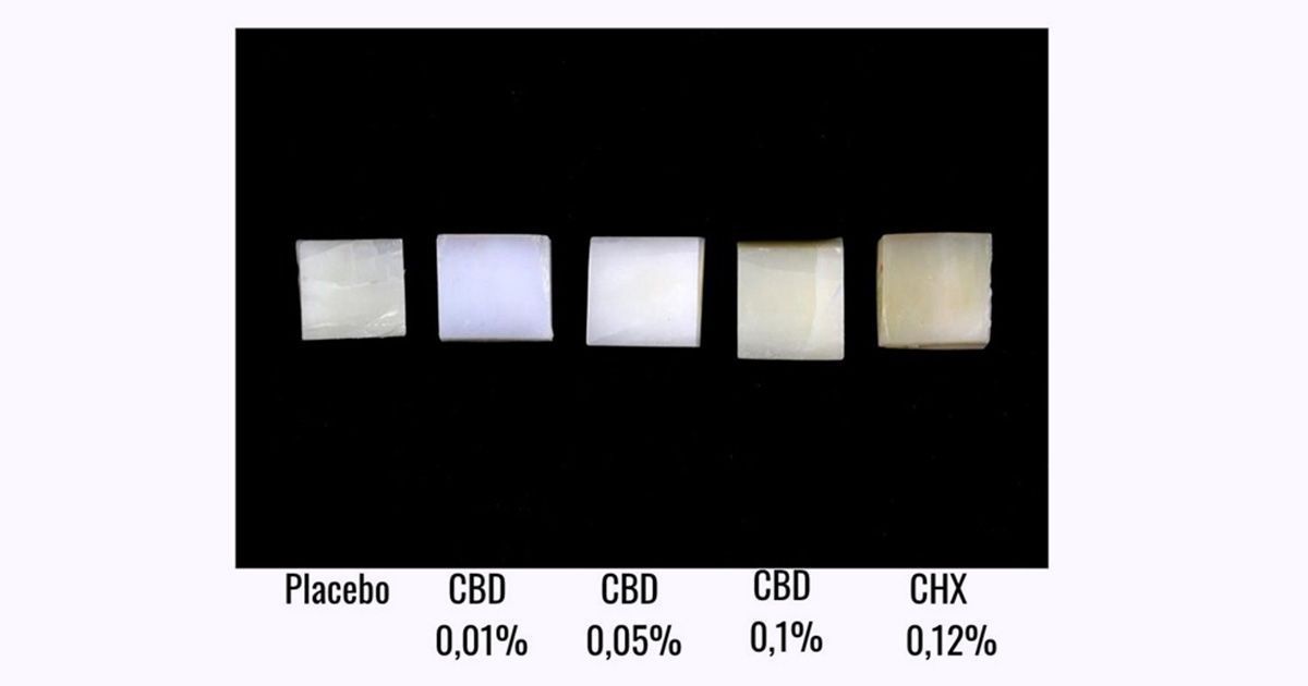Fragmentos de esmalte bovino após os diferentes tratamentos, com maior alteração de cor no grupo da clorexidina (CHX 0,12%) • Divulgação/USP