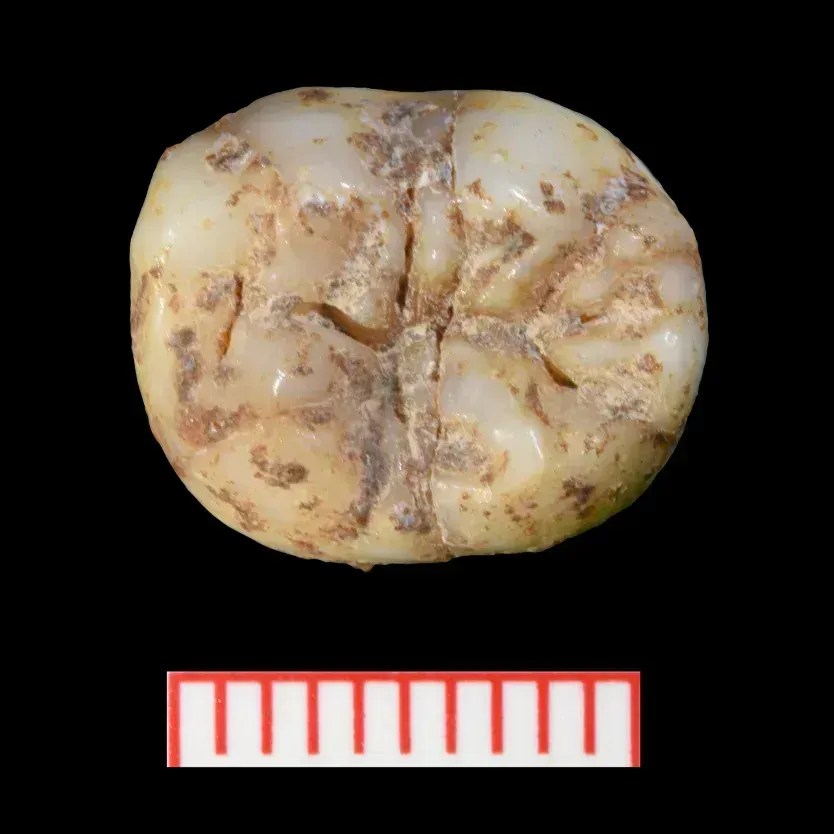 Os dentes dos denisovanos possuem sulcos e cristas que são exclusivos da espécie. • Canção Xing