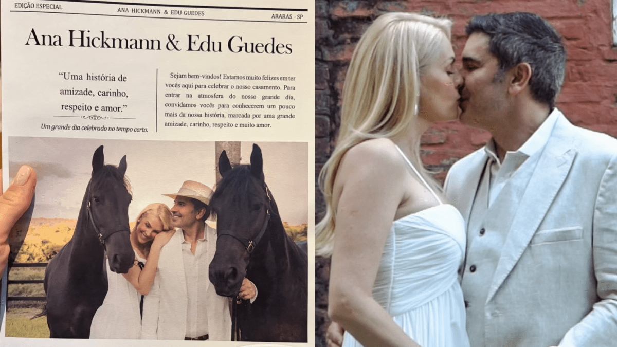 Ana Hickmann realizou procedimentos estéticos para casamento; veja quais